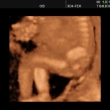 A moje noiky, kter na ultrazvuku kmitaly jako u maminky zamlada :D